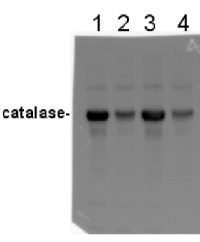 Cat | Catalase (peroxisomal marker) (100 ĩl) in the group Antibodies for Plant/Algal / Environmental Stress / Drought stress at Agrisera AB (Antibodies for research) (AS09 501-100)